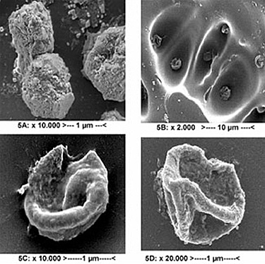Four examples of Aspergillus Niger spores untreated and treated with Pulsed UV
